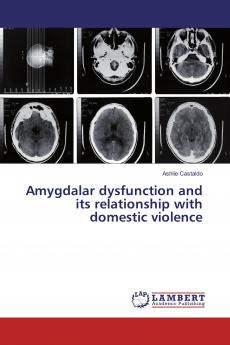 Amygdalar dysfunction and its relationship with domestic violence