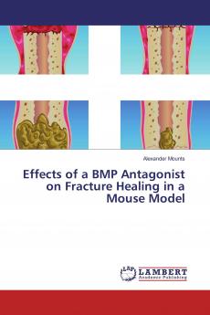 Effects of a BMP Antagonist on Fracture Healing in a Mouse Model