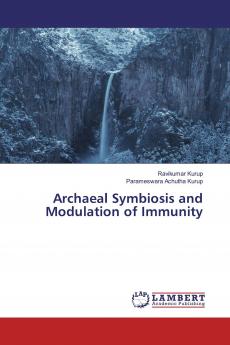 Archaeal Symbiosis and Modulation of Immunity