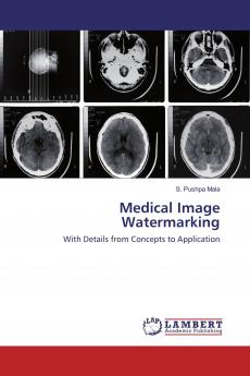 Medical Image Watermarking