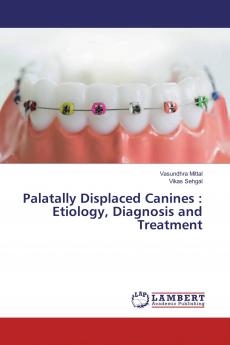 Palatally Displaced Canines : Etiology Diagnosis and Treatment
