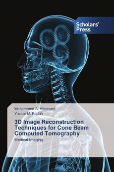 3D Image Reconstruction Techniques for Cone Beam Computed Tomography