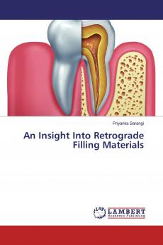 An Insight Into Retrograde Filling Materials