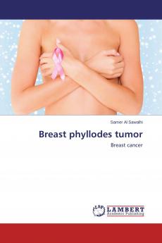 Breast phyllodes tumor