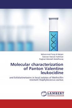 Molecular characterization of Panton Valentine leukocidine