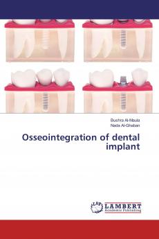 Osseointegration of dental implant