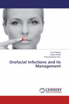 Orofacial Infections and its Management