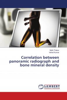 Correlation between panoramic radiograph and bone mineral density