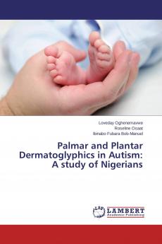 Palmar and Plantar Dermatoglyphics in Autism