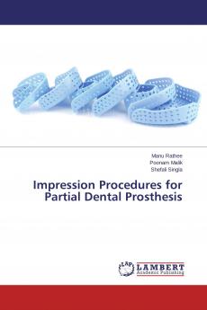 Impression Procedures for Partial Dental Prosthesis