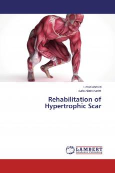Rehabilitation of Hypertrophic Scar