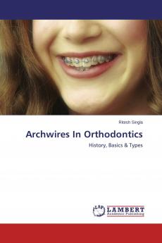 Archwires In Orthodontics