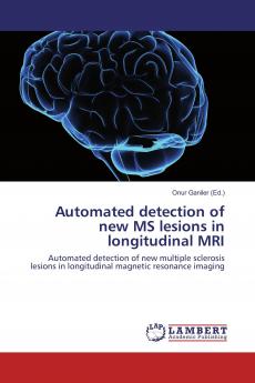 Automated detection of new MS lesions in longitudinal MRI