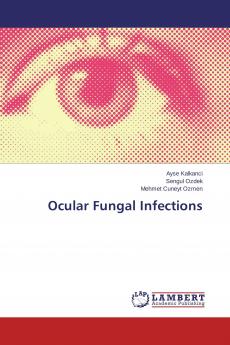Ocular Fungal Infections