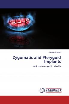 Zygomatic and Pterygoid Implants