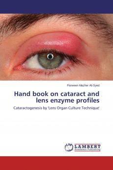 Hand book on cataract and lens enzyme profiles