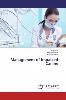 Management of Impacted Canine