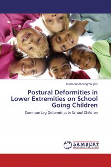 Postural Deformities in Lower Extremities on School Going Children