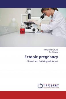 Ectopic pregnancy