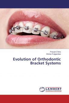 Evolution of Orthodontic Bracket Systems