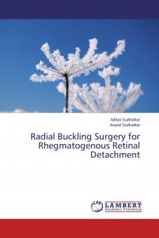 Radial Buckling Surgery for Rhegmatogenous Retinal Detachment