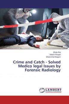 Crime and Catch - Solved Medico legal Issues by Forensic Radiology