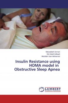 Insulin Resistance using HOMA model in Obstructive Sleep Apnea