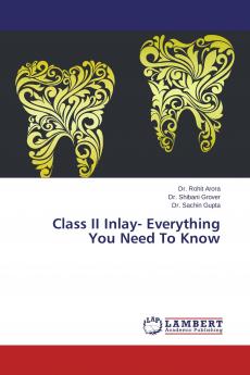 Class II Inlay- Everything You Need To Know