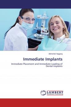 Immediate Implants