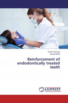 Reinforcement of endodontically treated teeth