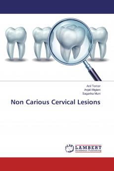 Non Carious Cervical Lesions