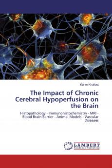 The Impact of Chronic Cerebral Hypoperfusion on the Brain