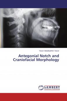 Antegonial Notch and Craniofacial Morphology