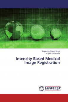 Intensity Based Medical Image Registration