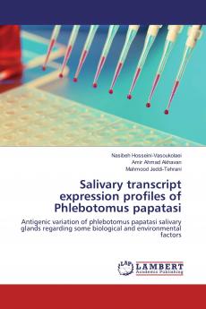 Salivary transcript expression profiles of Phlebotomus papatasi
