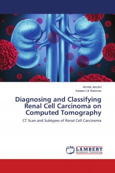 Diagnosing and Classifying Renal Cell Carcinoma on Computed Tomography