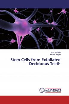 Stem Cells from Exfoliated Deciduous Teeth