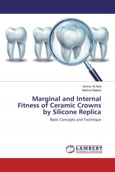 Marginal and Internal Fitness of Ceramic Crowns by Silicone Replica
