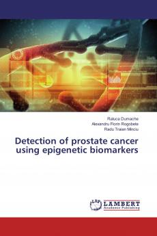 Detection of prostate cancer using epigenetic biomarkers