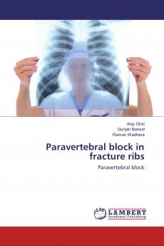 Paravertebral block in fracture ribs