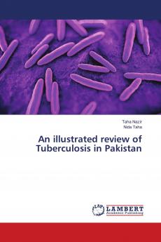 An illustrated review of Tuberculosis in Pakistan