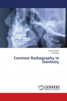 Contrast Radiography in Dentistry