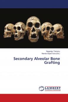 Secondary Alveolar Bone Grafting