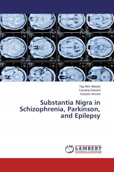 Substantia Nigra in Schizophrenia Parkinson and Epilepsy