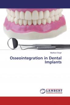 Osseointegration in Dental Implants