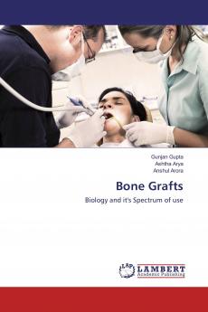 Bone Grafts