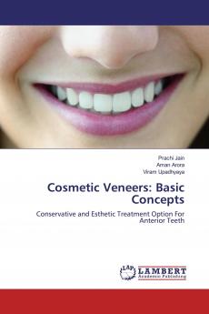 Cosmetic Veneers: Basic Concepts