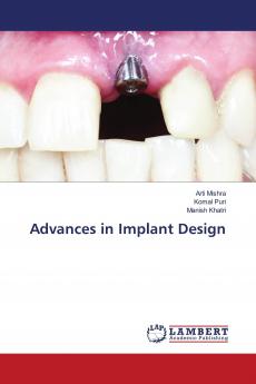 Advances in Implant Design