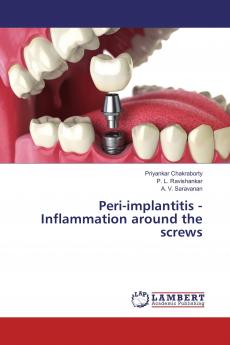 Peri-implantitis - Inflammation around the screws