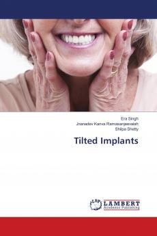 Tilted Implants